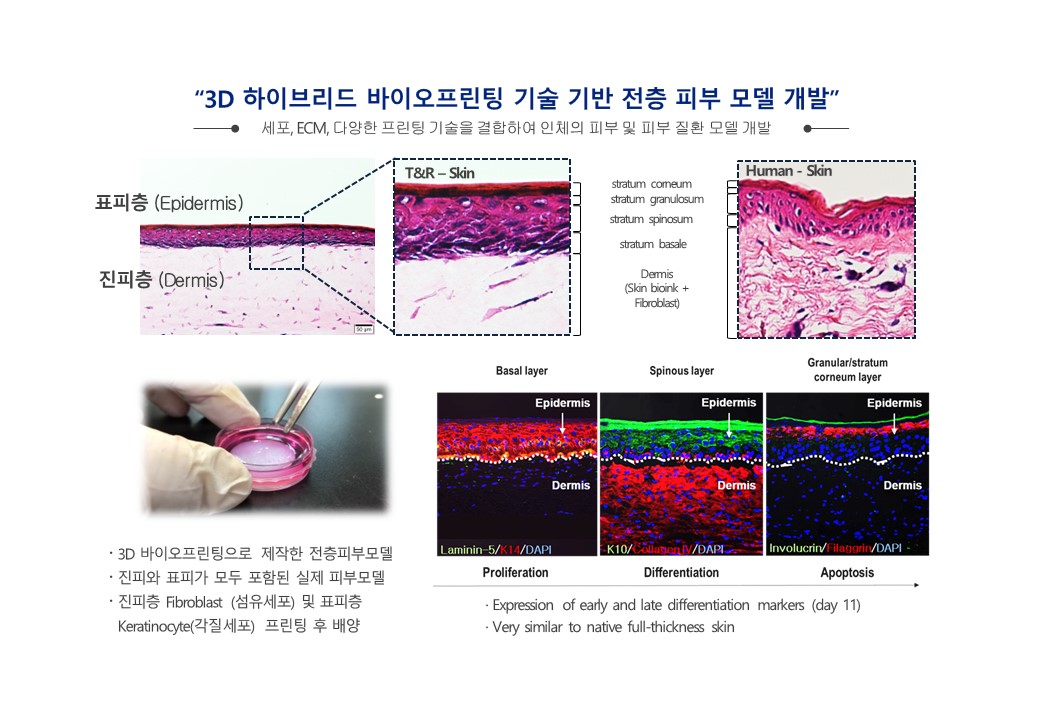이미지: 3D바이오프린팅 인공피부