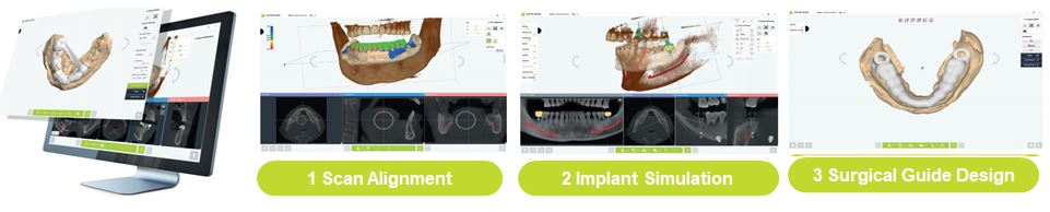 이미지: Surgical Guide S/W