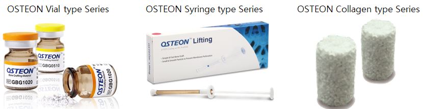 이미지: 합성골