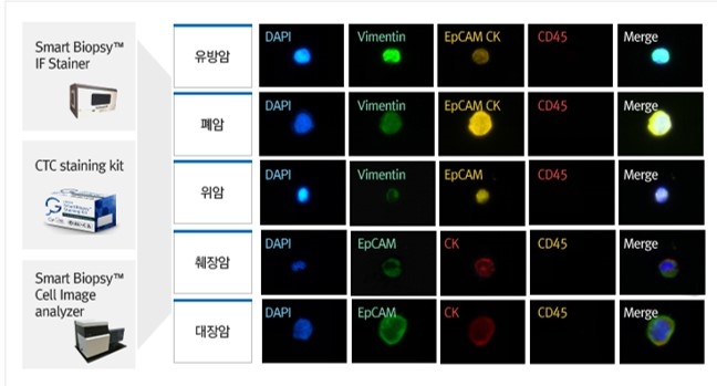 이미지: [다양한 암종에서의 CTC 검출 사례]