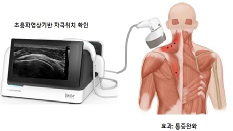 이미지: IMD20