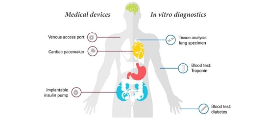 이미지: 체외진단기기
