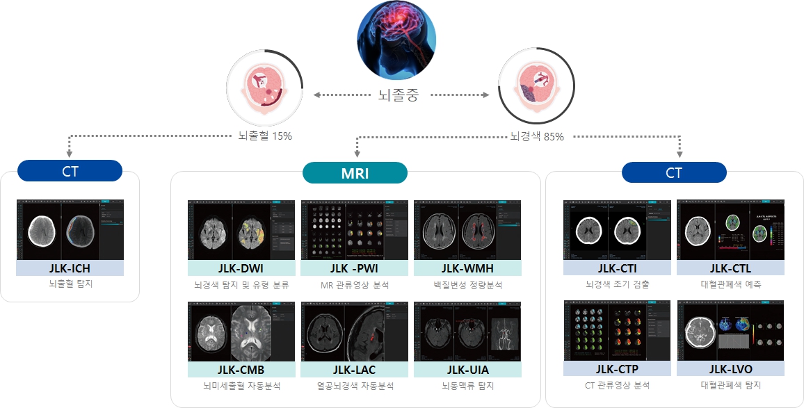 이미지: 뇌졸중 솔루션