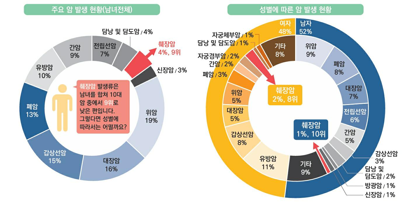 이미지: 췌장암의 발생 비율