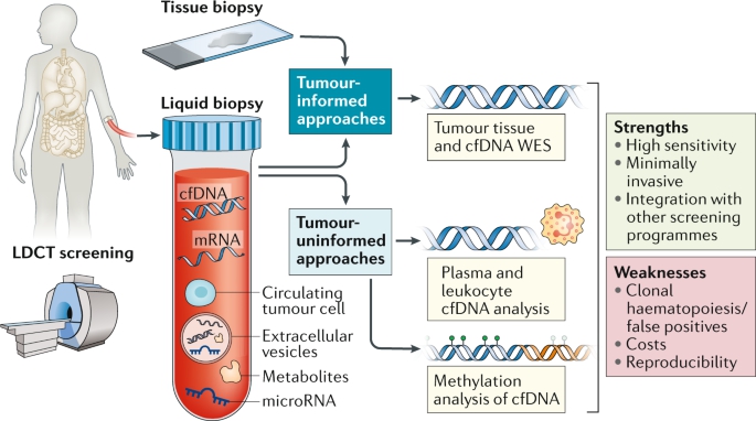 이미지: Liquid biopsy for early stage lung cancer