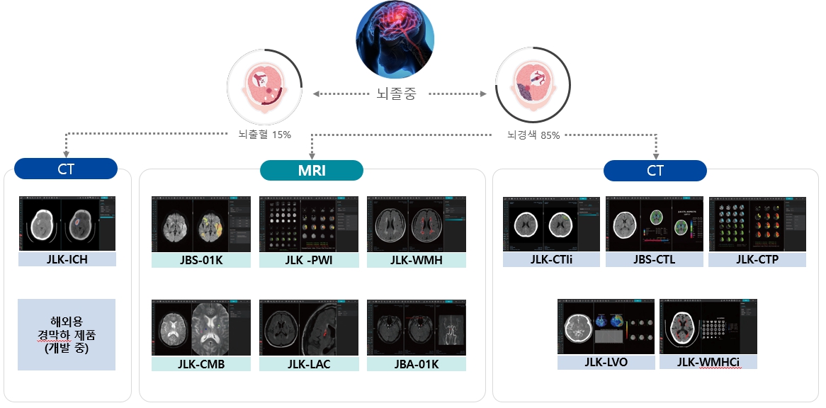 이미지: 제이엘케이 뇌졸중 솔루션