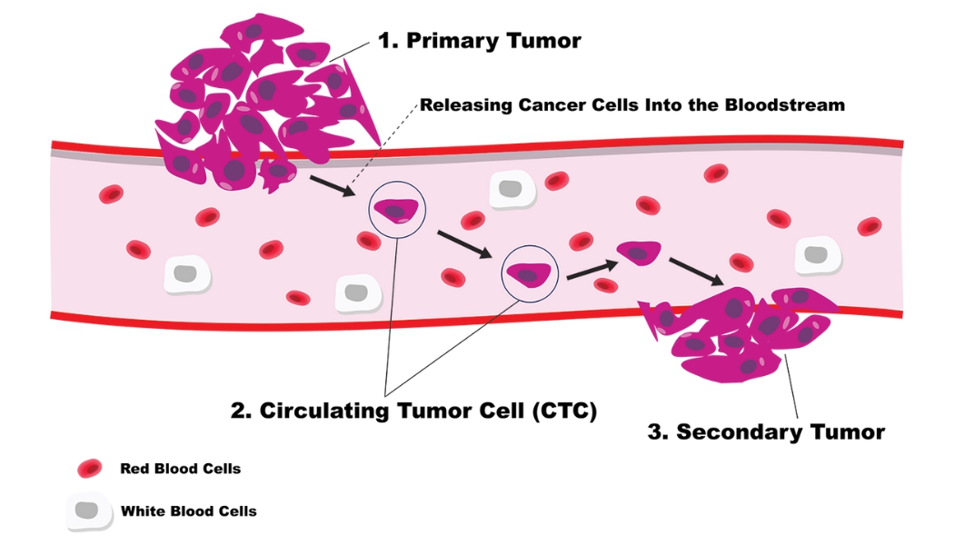 이미지: ctc(circulating tumor cell) 소개 및 전이 과정