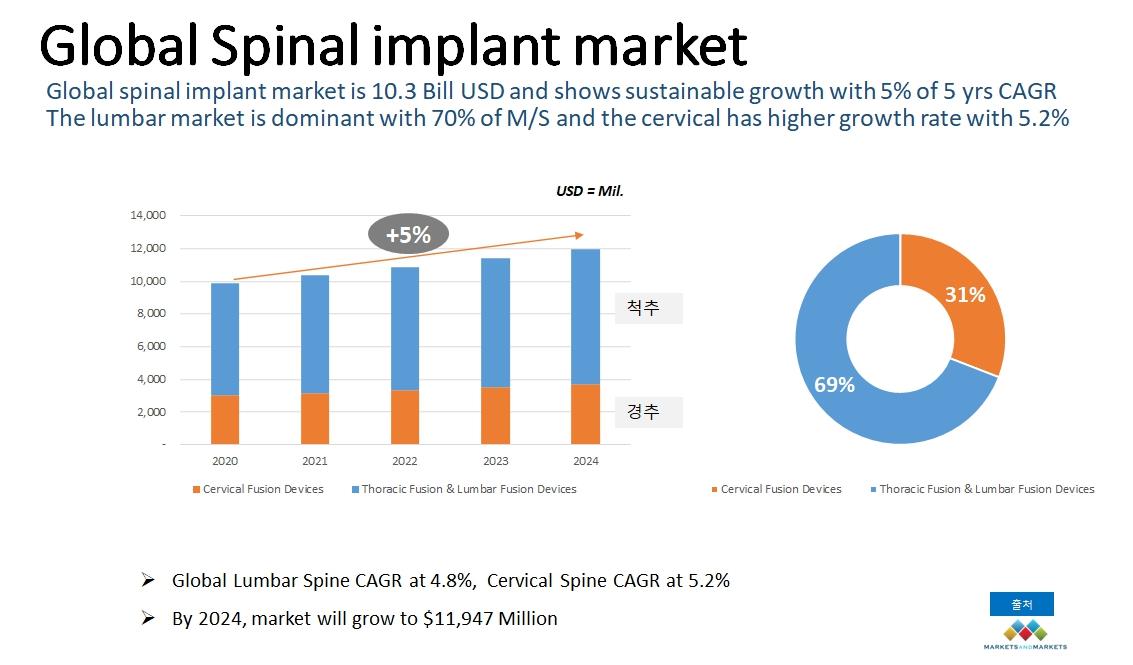 이미지: global spinal implant market