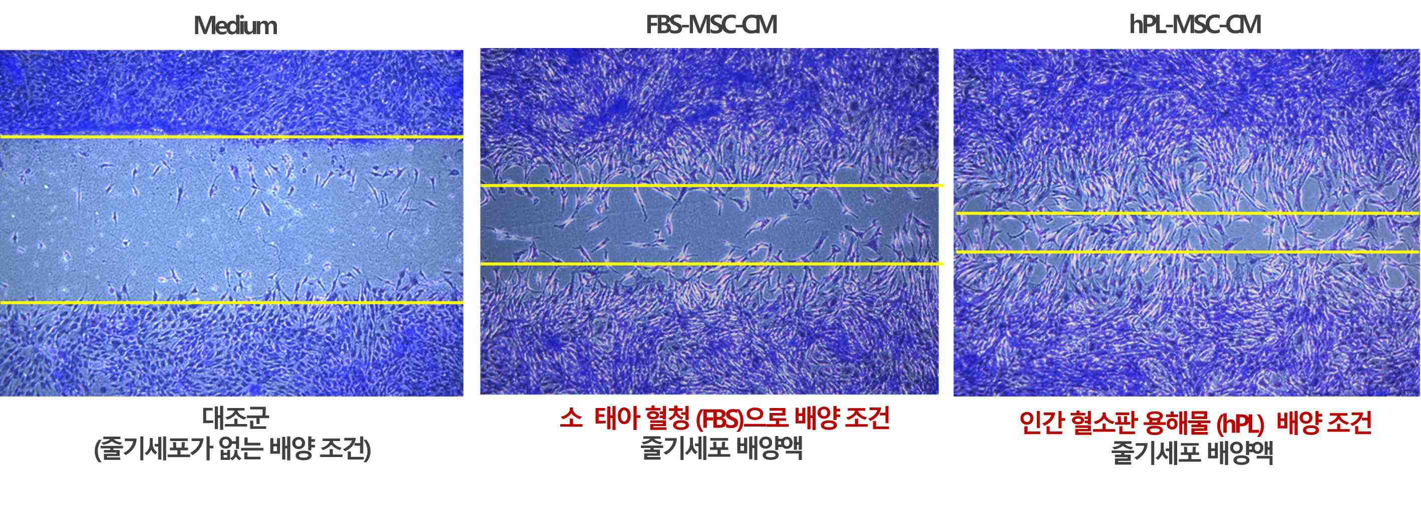 이미지: 진피 섬유아세포 피부 재생 효과 비교