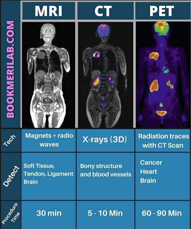 이미지: MRI CT PET 비교