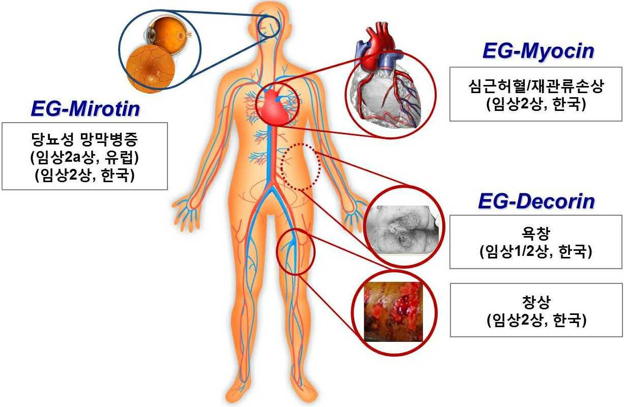 이미지: [아이진(주) 허혈성 질환 치료제 대표 적용분야]