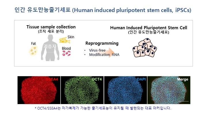 이미지: 인간 유도만능줄기세포 (Human induced pluripotent stem cells, iPSCs)