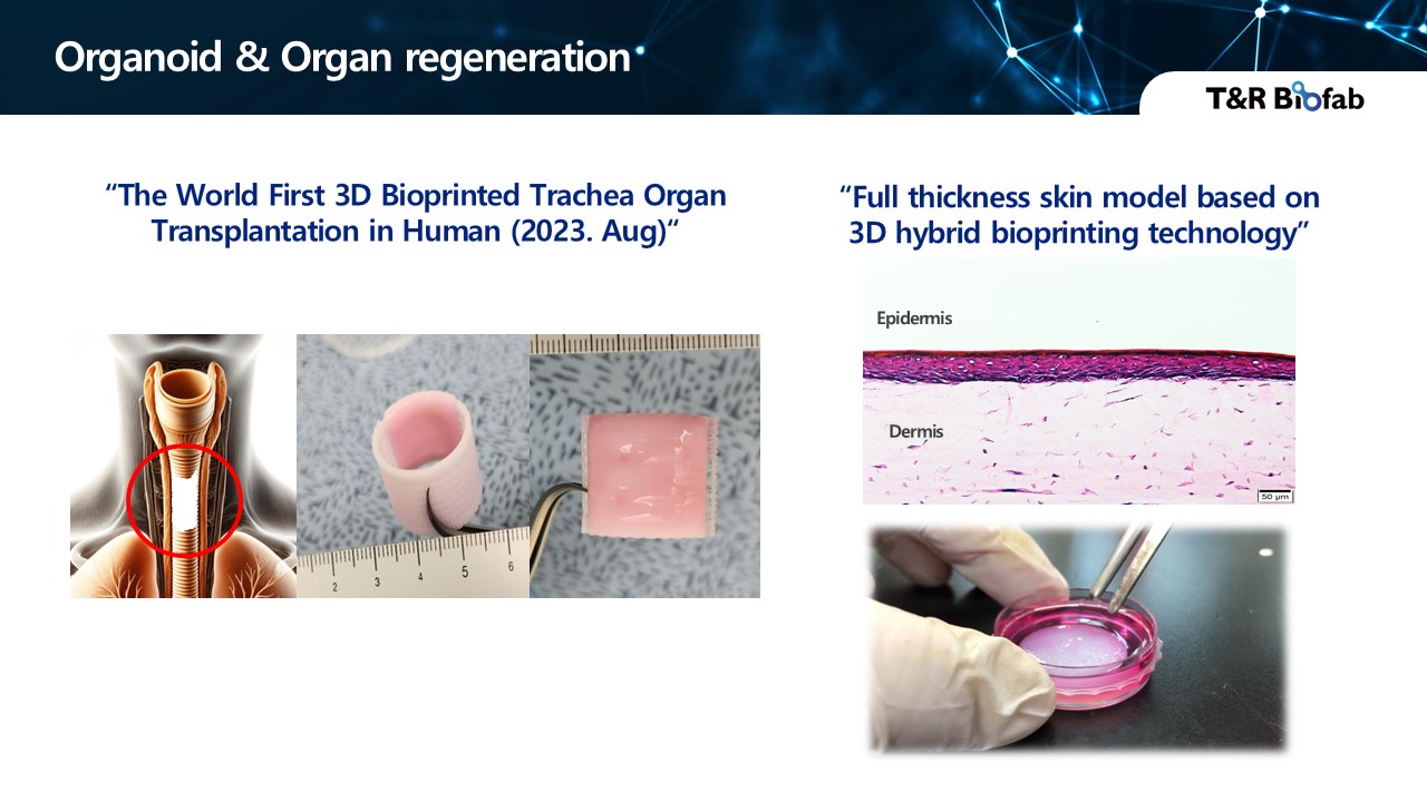 이미지: 오가노이드(trachea) & 인공피부