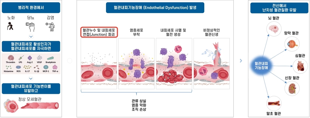 이미지: 혈관내피기능장애