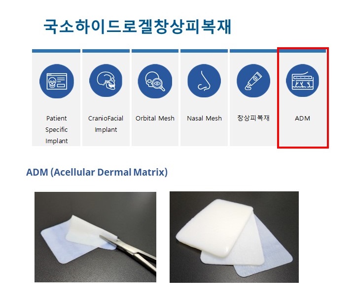 이미지: ADM (Acellular Dermal Matrix)