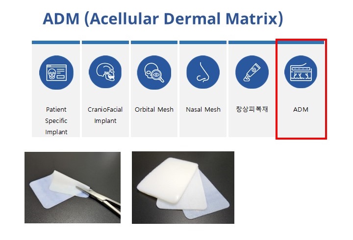 이미지: ADM (acelluar Dermal Matrix)
