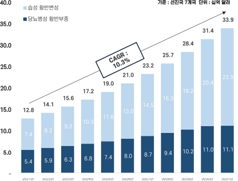 이미지: 당뇨병성 황반부종 치료제 시장 추이