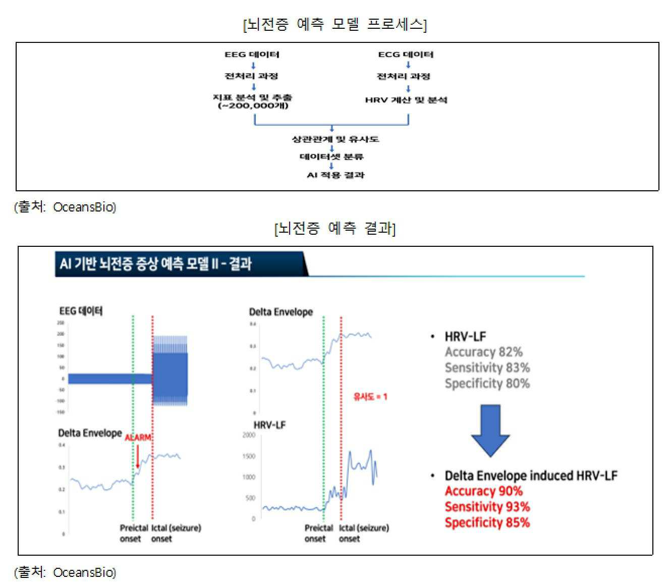 이미지: 뇌전증 예측 모형