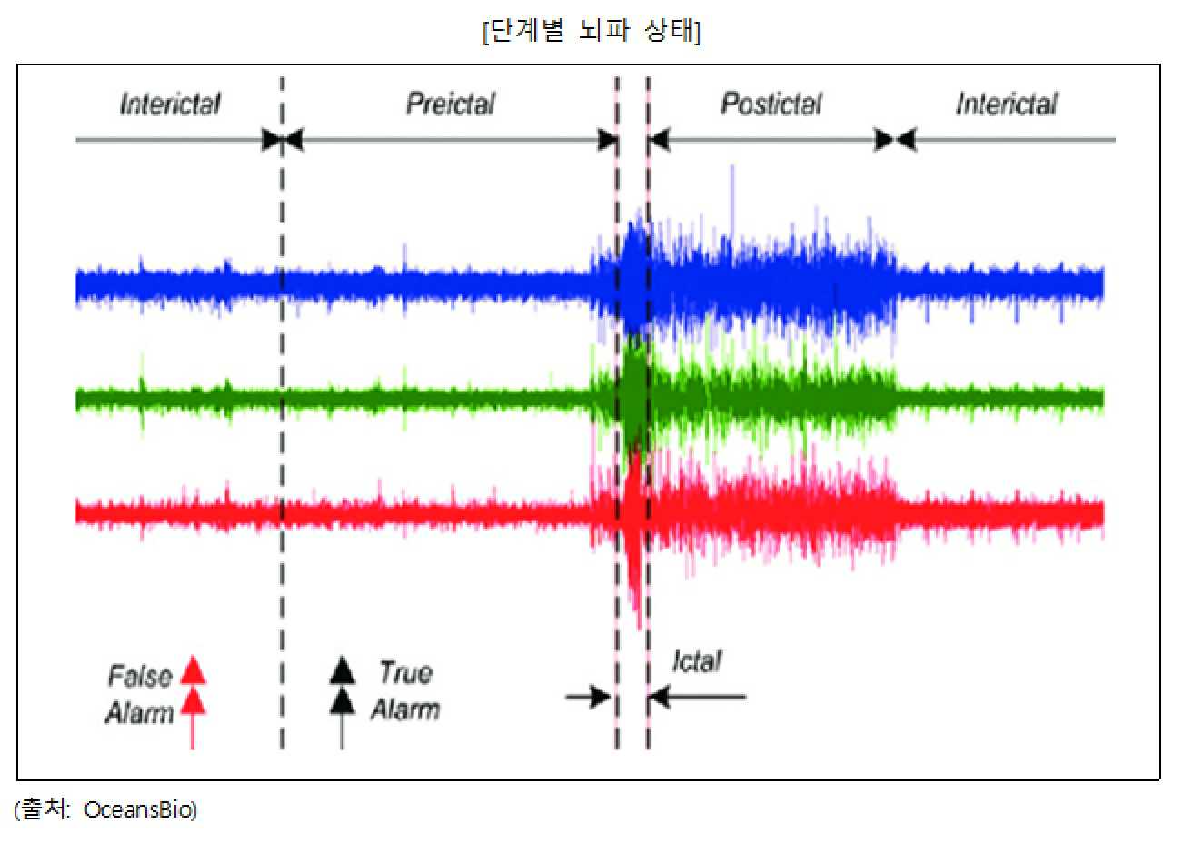 이미지: 단계별 뇌파 상태