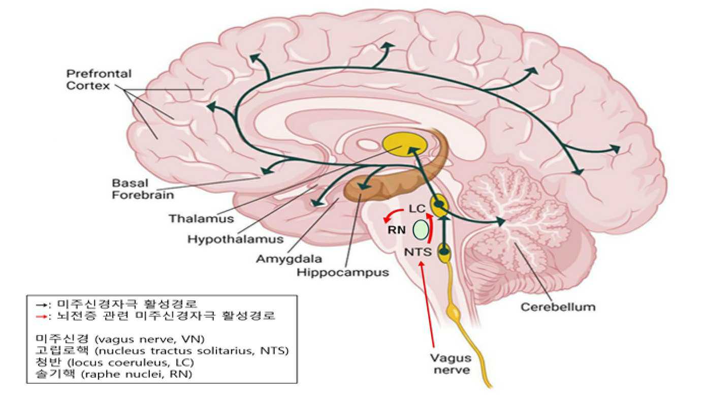 이미지: 미주신경자극 활성 경로