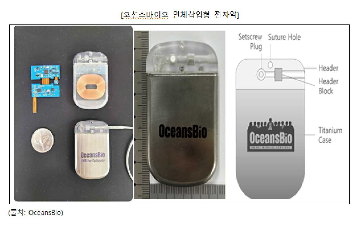 이미지: 오션스바이오 인체삽입형 전자약