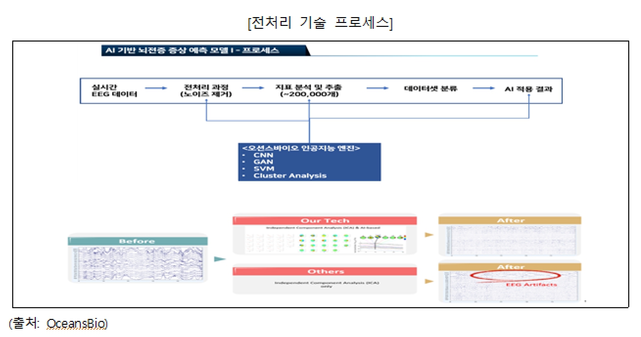 이미지: 전처리 기술 프로세스