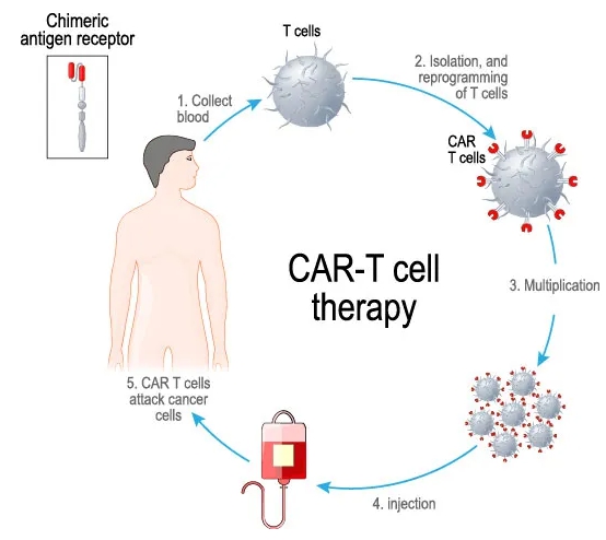 이미지: car-t 모식도