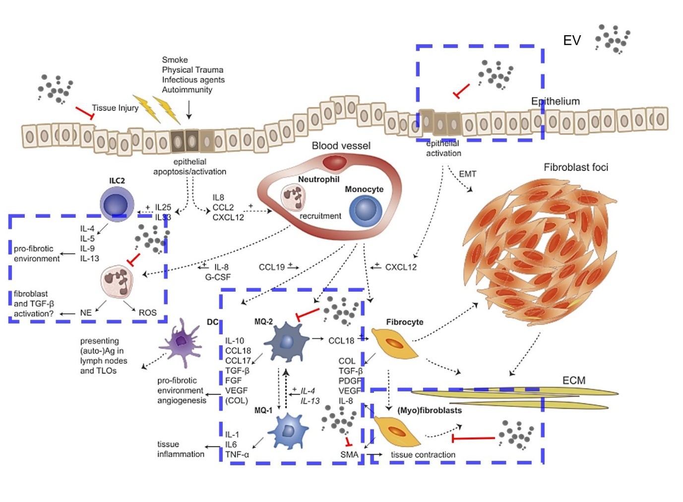 이미지: ev231lu20의 특발성 폐 섬유증의 작용기전