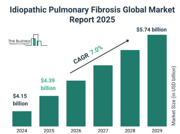 이미지: 글로벌 특발성 폐섬유화증 치료제 시장 전망