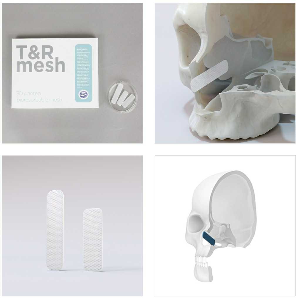 이미지: nasal mesh