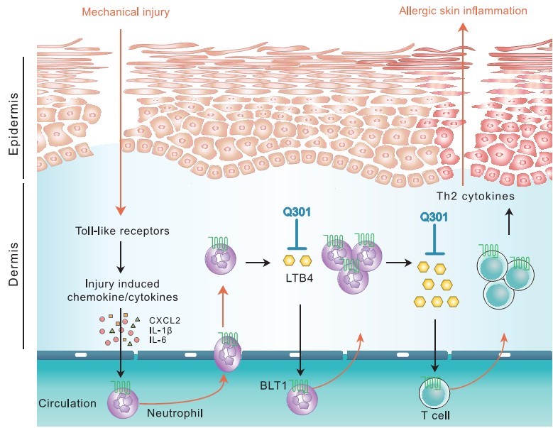 이미지: [5-LO 저해를 통한 아토피성피부염 치료 기전]