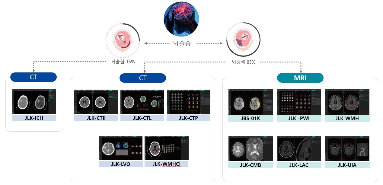 이미지: 제이엘케이 뇌졸중 솔루션