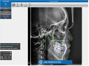 이미지: [ LaonCeph 인공지능 landmark 적용후 두개골 영상 이미지 ]