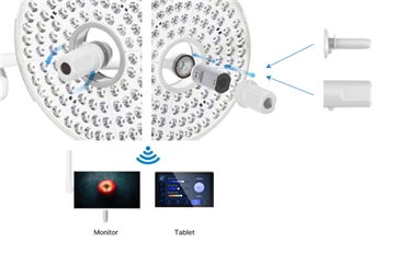 이미지: 수술용 무영등