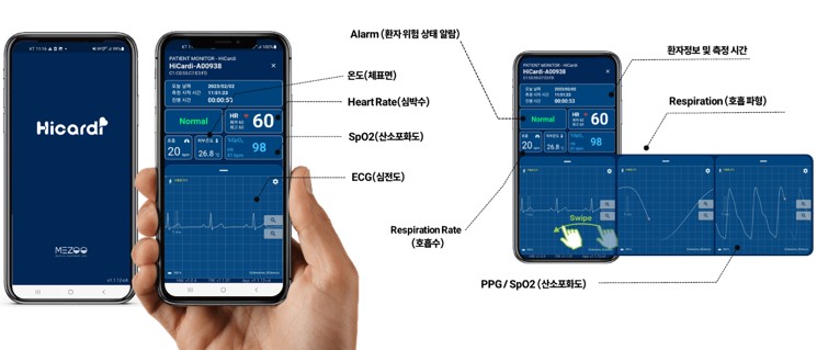이미지: SmartVIew의 기능 및 사양