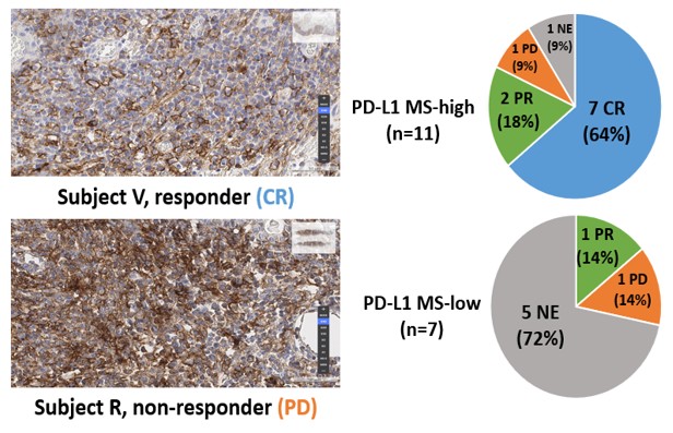 이미지: Tumor response by PD-L1 MS